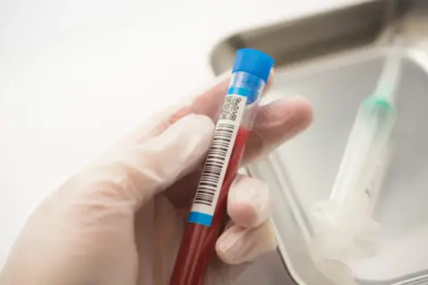 どんな検査で糖尿病が分かる？