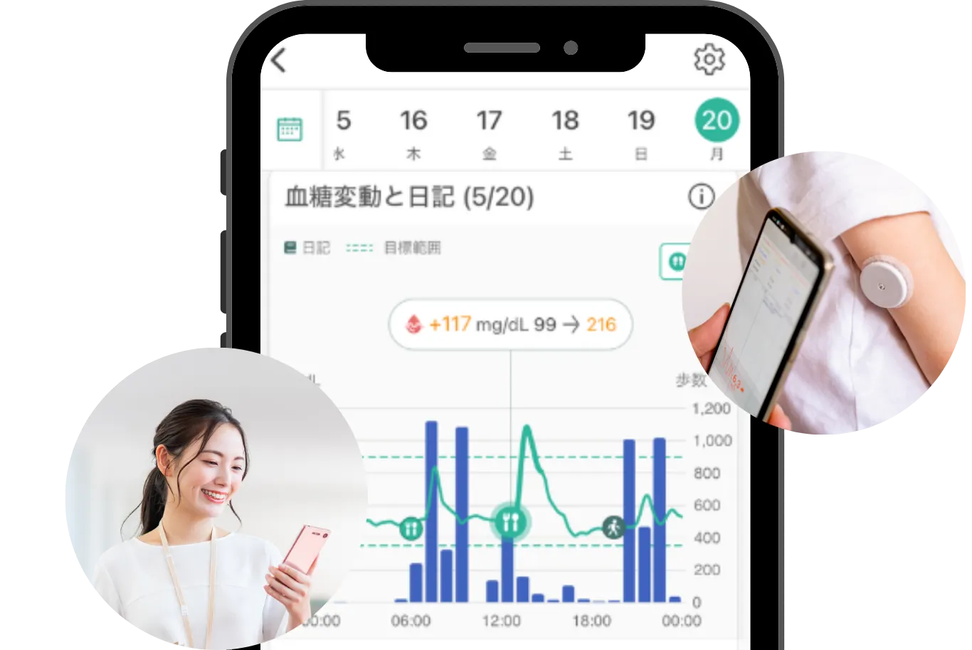 リブレやアプリの活用で負担が減り治療が続けやすい